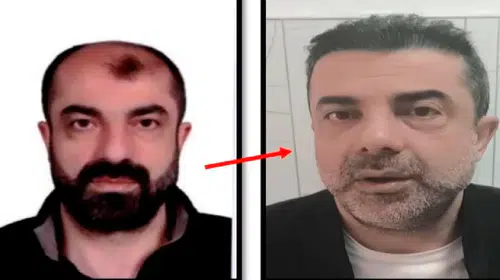 Cinayet şüphelisinden estetikli firar: Yüzünü değiştirdi ama adaletten kaçamadı