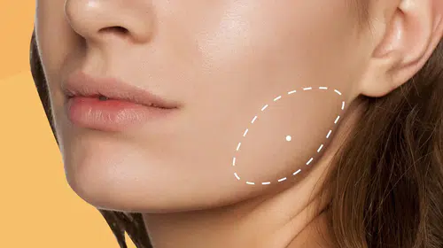 Masseter Botoks: Kalıcı mı, Geçici mi?