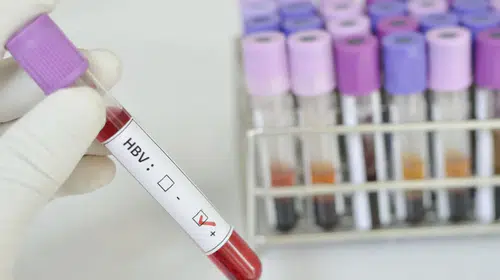 Sessiz tehlikeye karşı kritik uyarı: 300 milyondan fazla insan risk altında!