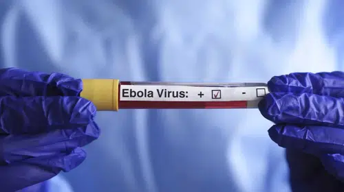 DSÖ’den Ebola alarmı: Vaka sayısı 6 bini, can kaybı 3 bini aştı