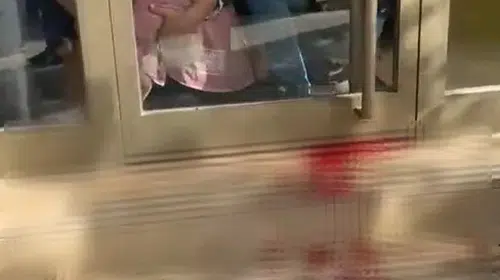 Bursa'da dehşet anları: Fatura tartışmasında hamile kadına tahralı saldırı