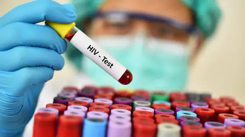 HIV araştırmalarında dikkat çeken gelişme: Virüs 4 yıl boyunca kanda tespit edilemedi