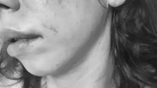 Kadına şiddete sıfır tolerans: Eşini darbeden koca tutuklandı