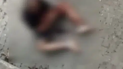 Zeytinburnu'nda sokak kavgası: Bir kişi başından yaralandı