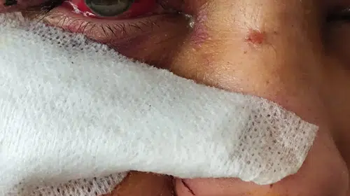 Polis memuruna eşini darp davasında hapis ve tahliye