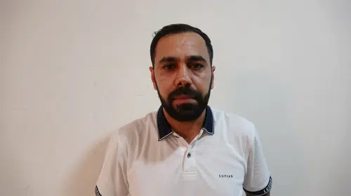 Estetik ameliyat sonrası burnunda nekroz oluşan hasta, 40 bin avroluk tedavi için hukuk mücadelesi başlattı