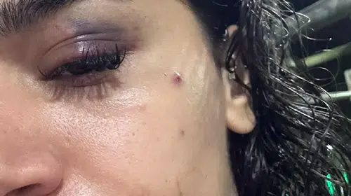 Uzaklaştırma kararı kalkan olmadı: Hemşire Ebru'nun çığlığına kulak verin