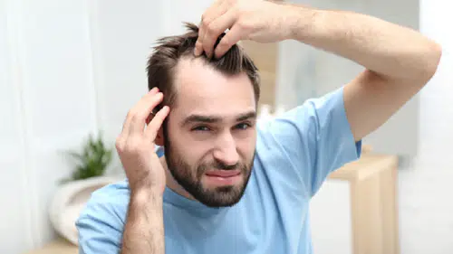 Erkek tipi saç dökülmesinde devrim! Yeni ilaç saç çıkışını yüzde 539 artırdı: 30 yılın en büyük ilerlemesi
