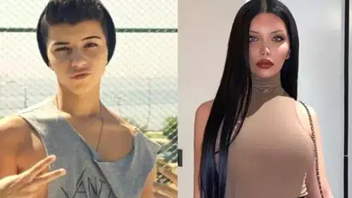 Cinsiyet değiştiren fenomen Beren Güney’den dikkat çeken estetik itirafı: Kemik eklettim