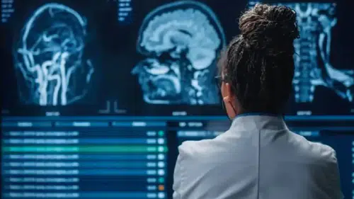 Ölüm anında beyin susmuyor: Bilim insanları son saniyelerde hiperaktivite tespit etti