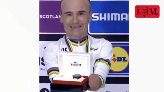 Çocukluğunda kollarını kaybeden sporcuya, kol saati hediye edildi