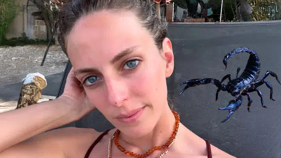 Bige Önal'ı akrep soktu, hastaneye yetiştiren oyuncu arkadaşı Necip Memilli oldu