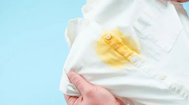 Beyaz kıyafetlerdeki sarı lekeler nasıl çıkar: 5 doğal yöntem