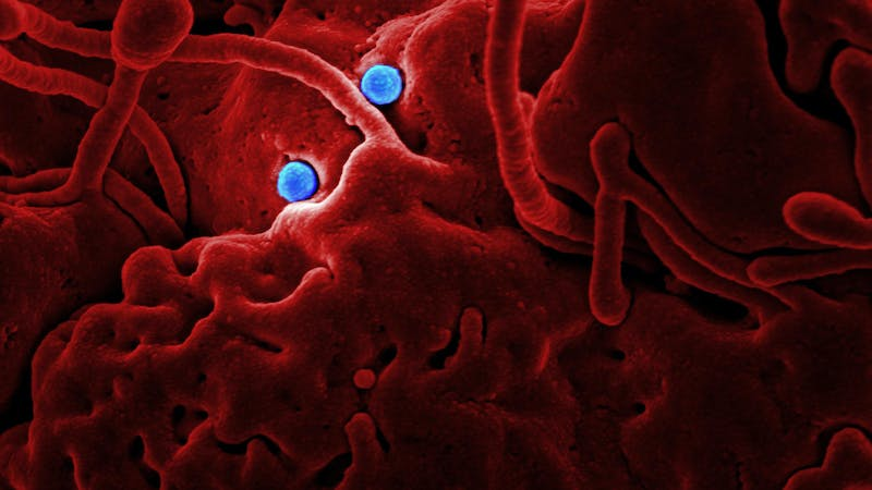 Üst solunum yolu enfeksiyonlarına karşı beslenme önerileri 2