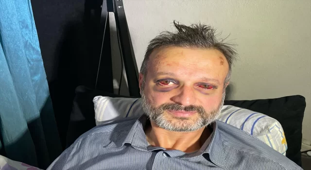 Bursa’da eğlence mekanında darbedilen piyanist yaralandı 