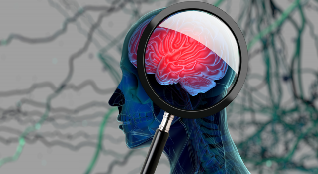 Bilim insanları, beyin taramasında demansı tespit edebilecek teknoloji üzerinde çalışıyor