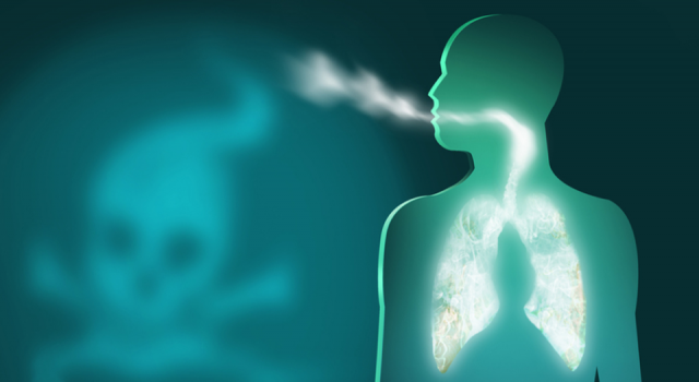 Akciğer kanseri hastası her 10 kişiden 9'u tütün kullanıcısı!