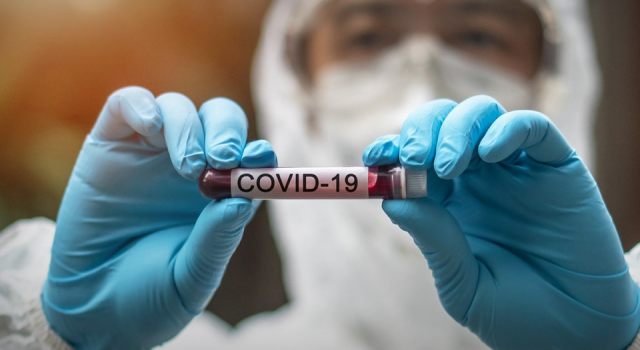 Kovid-19 Pandemisi 'Endemi' haline mi geliyor