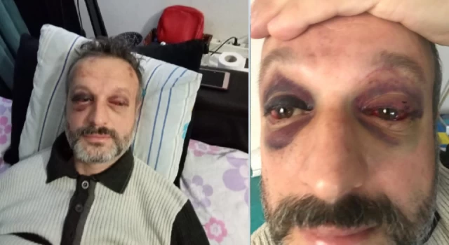 Bursa’da istek şarkıyı çalmayan müzisyen Özkan Süslerer öldüresiye dövüldü