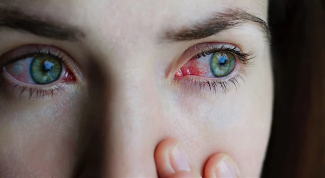 Gözlerdeki yeni salgının kaynağı: Adenovirüs