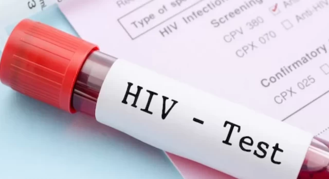 HIV tedavisinde güzel gelişmeler