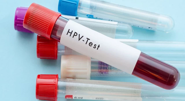 Her 10 kişiden 8'i HPV ile karşılaşıyor: Kadın-erkek herkes aşı yaptırmalı