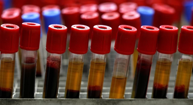 Bilim insanları açıkladı: Kan grubumuz kişiliğimizi etkiliyor
