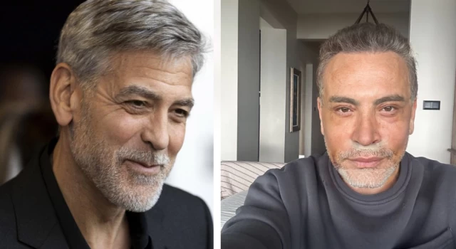 Yüz germe ameliyatı olan şarkıcı Cenk Eren: Ben Türkiye’nin George Clooney’siyim