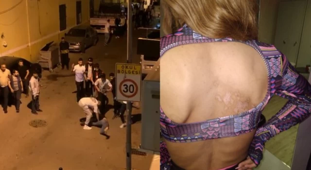 İzmir'de trans kadına öldüresiye şiddet