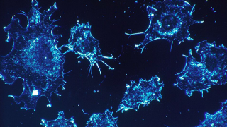 Korkutan araştırma: Kanser hücreleri kış uykusuna geçerse...
