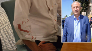 Beyzbol sopasıyla saldırıya uğrayan Didim Belediye Başkanı konuştu: Pes etmeyeceğiz