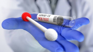 300 TL’ye negatif garantili PCR testi