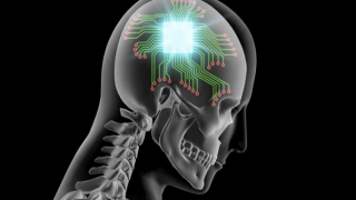 Depresyon için kapama düğmesi: Deneysel beyin implantı tedavisi başarılı
