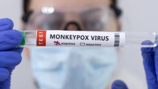 Maymun çiçeği virüsü üç ülkede daha görüldü