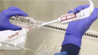 Laboratuvar üretimi olan kan ilk kez insana nakledildi