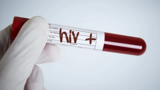 HIV görülme yaşı 15’e kadar indi