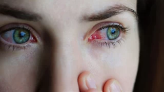 Gözlerdeki yeni salgının kaynağı: Adenovirüs