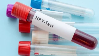Her 10 kişiden 8'i HPV ile karşılaşıyor: Kadın-erkek herkes aşı yaptırmalı