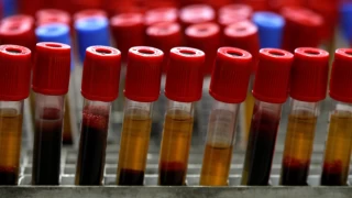 Bilim insanları açıkladı: Kan grubumuz kişiliğimizi etkiliyor