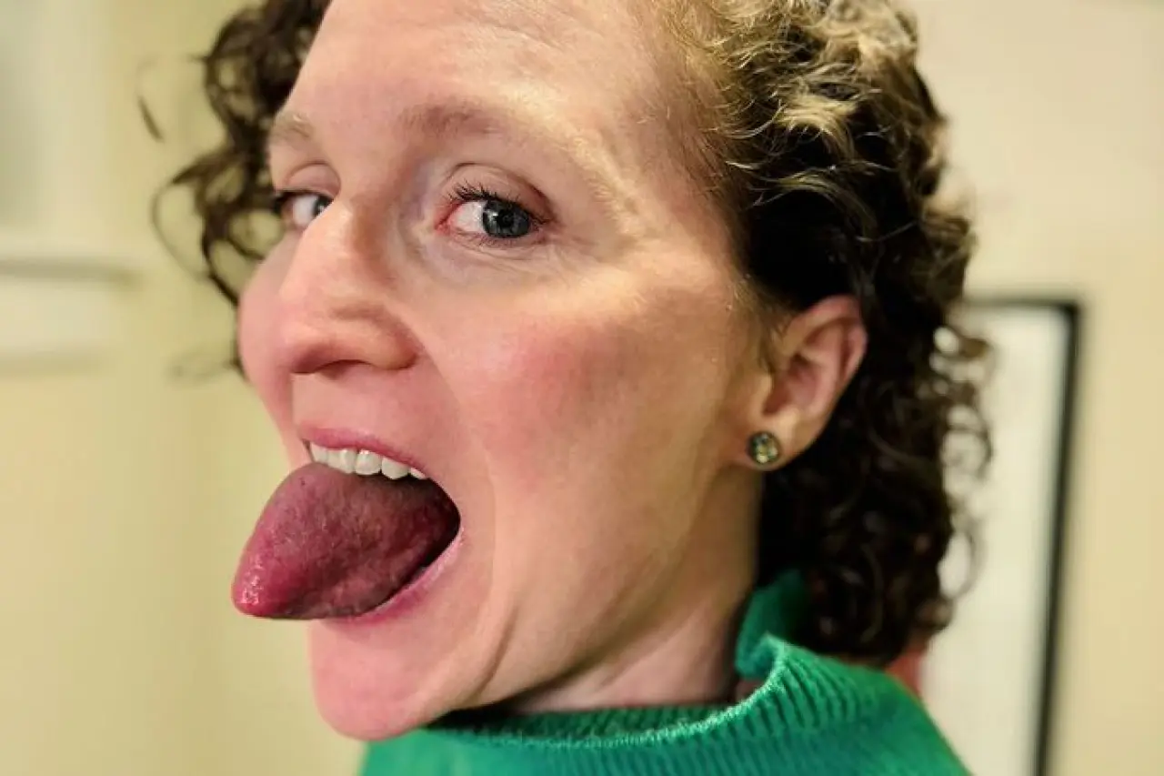 Gerçek olduğuna zor inanacağınız kadınlar ve eşsiz vücut özellikleri 18