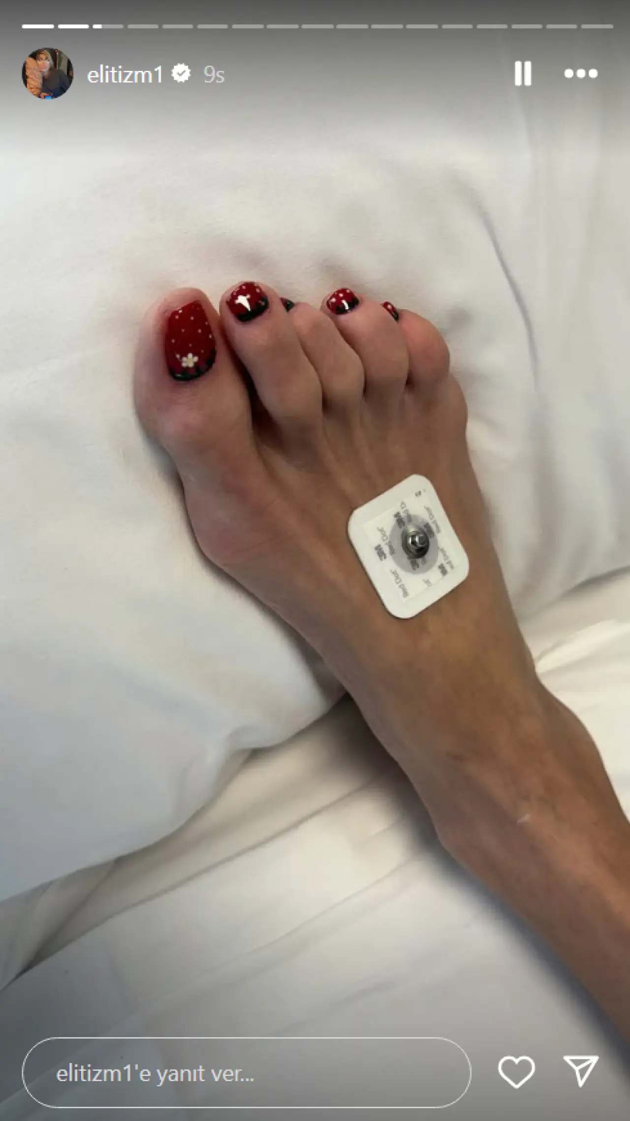 Nihal Candan'ın yoğun bakımdan görüntüsü ortaya çıktı! Bahar Candan'dan şaşkına çeviren paylaşımlar: Abla ölme lütfen ölme 6