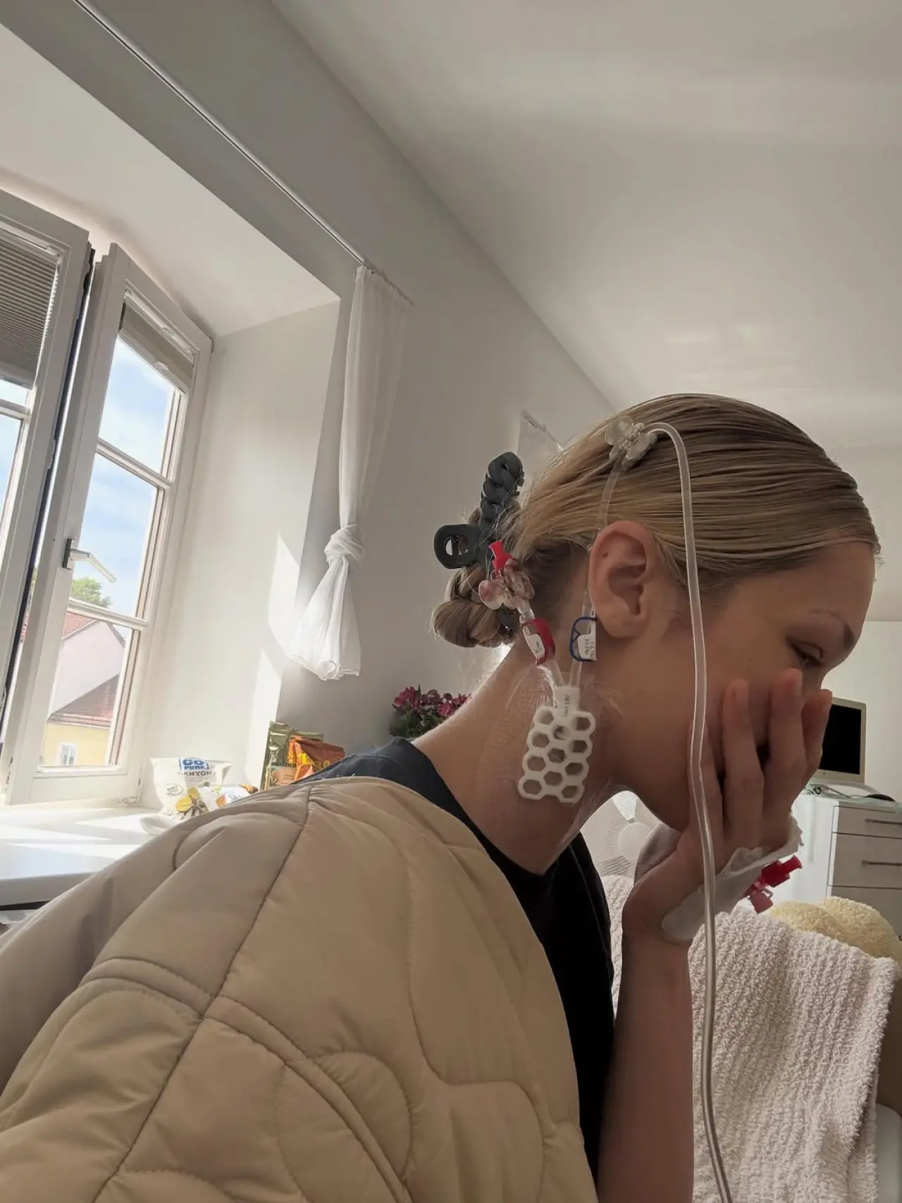 Bella Hadid, Lyme hastalığıyla mücadelesini paylaştı: Hep ortadan kayboluyorum 5